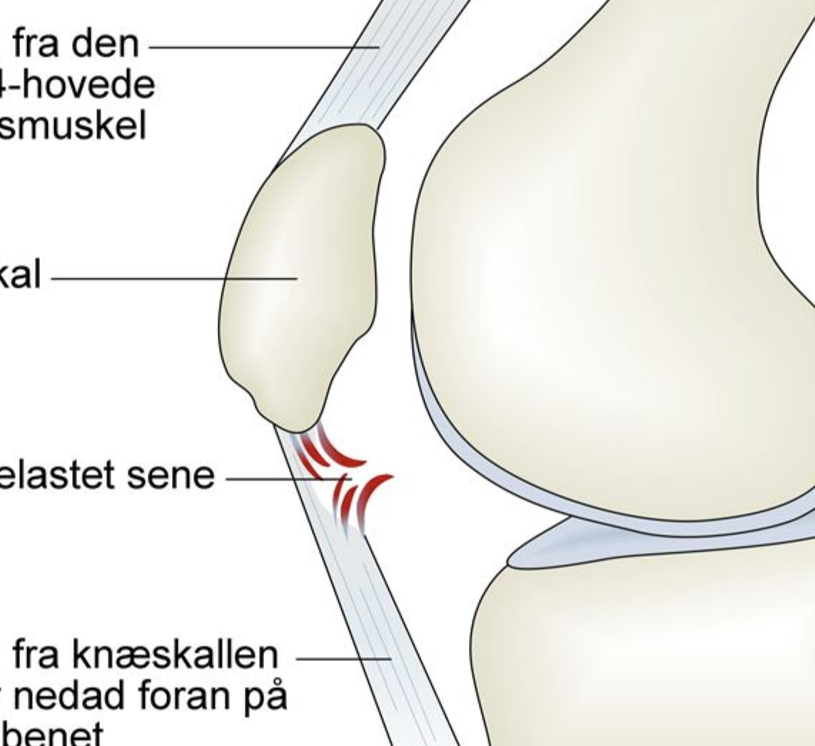 Springerknæ